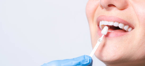 Best Cosmetic Dentistry in Kothrud, Pune