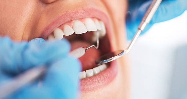 Best Dental Clinic in Kothrud Pune